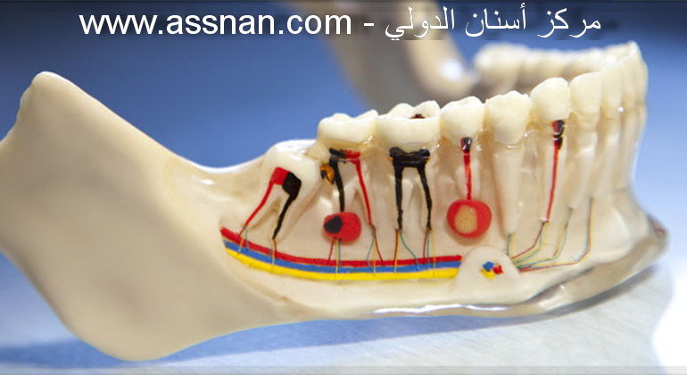 أعصاب وخراجات الأسنان - مركز أسنان الدولي