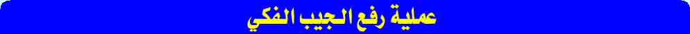عملية رفع الجيب الفكي 