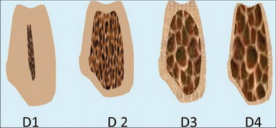 zira3a-kakopotrazis2