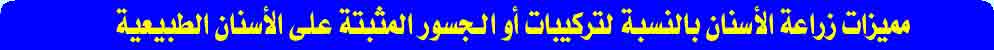 ما هي مميزات زراعة الأسنان بالنسبة لتركيبات المثبتة على الأسنان الطبيعية ( الجسور )