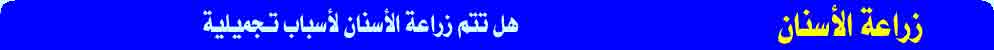 هل تتم زراعة الأسنان لأسباب تجميلية