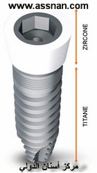 زرعات TBR  ذات العنق الزيركوني التي لا تسبب التهابات اللثة 
