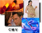  CMV 