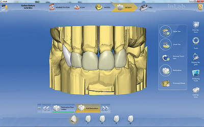 برمجة الأسنان الزيركونية على الكمبيوتر 