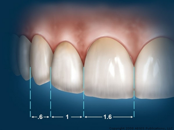 مقاييس الأسنان والتي نستخدمها للحصول على أبتسامة هوليود